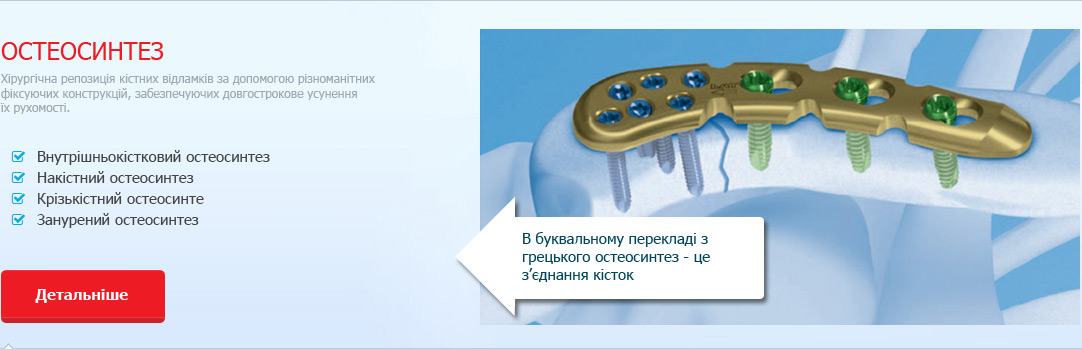 Остеосинтез - в буквальному перекладі з грецького це з’єднання кісток